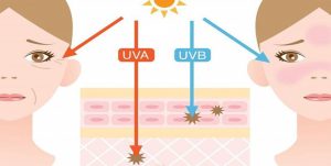 اشعه UV و انواع آن